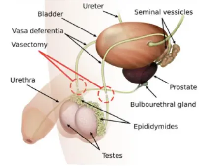 Vasectomy anatomy